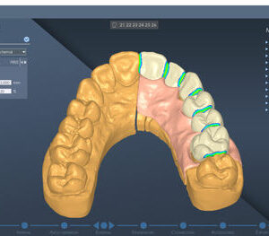 Программное обеспечение CFAO, DentalCad, E.G.S. SRL